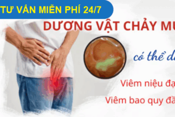 Dương vật chảy mủ xanh do đâu? Có phải biểu hiện bệnh lậu?