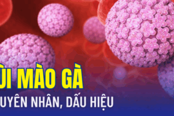 4 Nguyên Nhân Lây Nhiễm Sùi Mào Gà Nên Biết Để Phòng Tránh