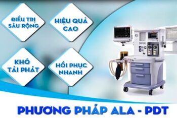 Phương pháp ALA – PDT: Giải pháp hiện đại trong điều trị sùi mào gà