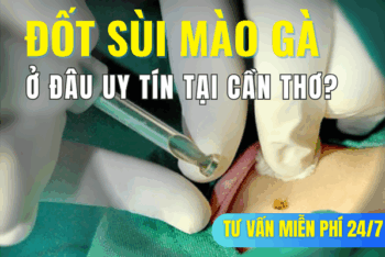 MỤN THỊT VÙNG KÍN NAM: NGUYÊN NHÂN VÀ CÁCH CHỮA TRỊ HIỆU QUẢ