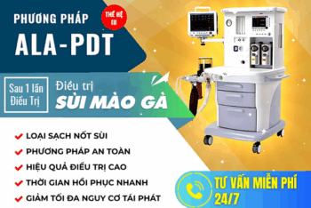Điều trị sùi mào gà hiệu quả: Áp dụng công nghệ tiên tiến tại Cần Thơ