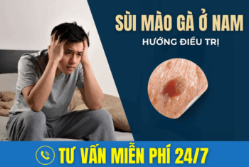 Giải Đáp: Cách Trị Sùi Mào Gà Ở Nam