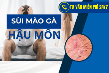 LÒI CỤC THỊT Ở HẬU MÔN LÀ GÌ? CÓ NGUY HẠI GÌ KHÔNG?