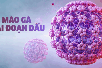 Sùi Mào Gà Giai Đoạn Đầu Ở Nữ Giới Có Tự Khỏi Được Không?