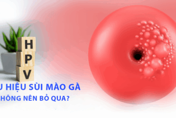 Nhận biết các dấu hiệu sùi mào gà không nên chủ quan