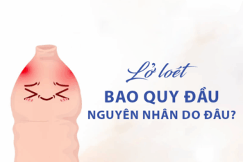 Lở loét bao quy đầu do đâu? Khi nào cần đi khám bác sĩ ngay?