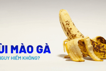 Sùi mào gà có nguy hiểm không? Giải đáp từ chuyên gia
