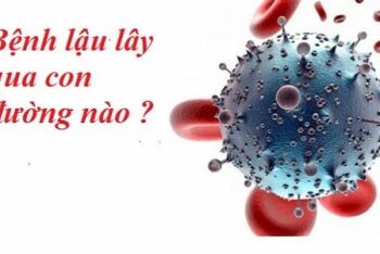 Lây Bệnh Lậu Qua Đường Nào? Biện Pháp Phòng Ngừa Nên Biết?