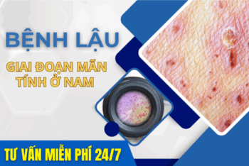 Giai Đoạn Mãn Tính Bệnh Lậu Ở Nam Nên Biết