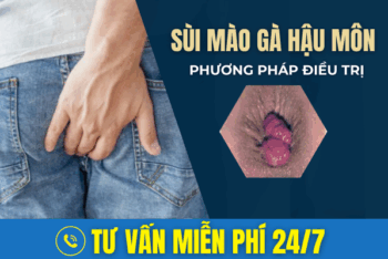 Các Phương Pháp Chữa Sùi Mào Gà Hậu Môn Hiệu Quả