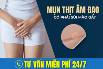 Mụn Thịt Âm Đạo Là Bệnh Gì? Có Phải Sùi Mào Gà?