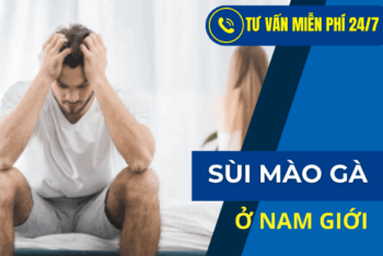 4 Điều Cần Biết Để Điều Trị Sùi Mào Gà Ở Nam Giới Hiệu Quả