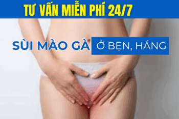 Sùi Mào Gà Ở Bẹn, Háng Và Cách Điều Trị