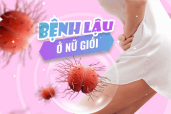 Chữa Trị Bệnh Lậu Ở Nữ Bao Lâu Thì Khỏi?