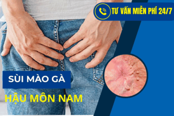 Cẩn Trọng Với Bệnh Sùi Mào Gà Ở Hậu Môn Nam